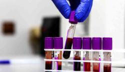 Rusia da un paso gigante con los primeros ensayos clínicos de una vacuna contra el cáncer