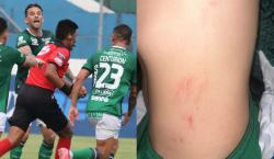 “El robo del siglo”: Centurión estalla contra el arbitraje tras el empate de Oriente