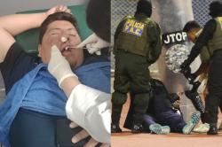 Funcionario de Blooming sufre fractura en el rostro tras agresión en Oruro y será sometido a cirugía