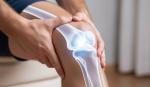 Dolor articular, cómo saber si es artritis o una lesión deportiva