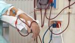 Sedes prepara campaña de cirugías de fístulas para pacientes en diálisis